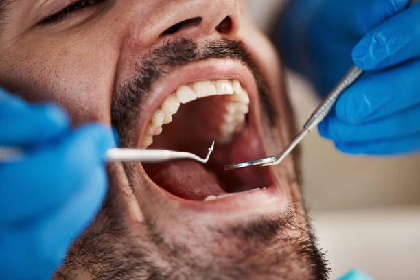 Best Emergency Dental Care for Sports Injuries in Cartervle, IL