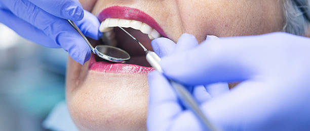 Best Weekend Emergency Dental Services in Cartervle, IL